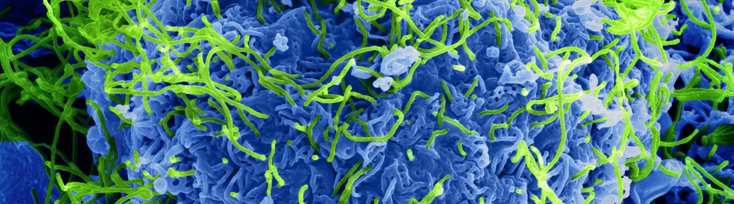 Ebola virus particles both budding and attached to the surface of infected VERO E6 cells