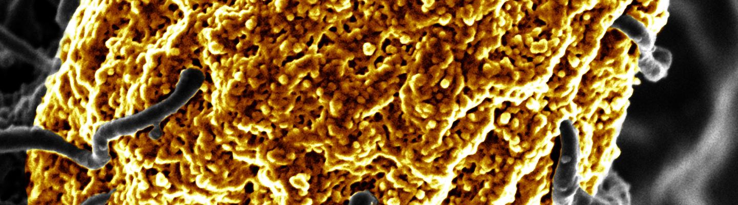 Scanning electron micrograph of phagocytosis of a dead yeast particle (zymosan)