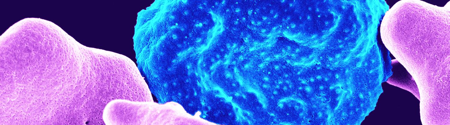 Malaria Infected Blood Cell